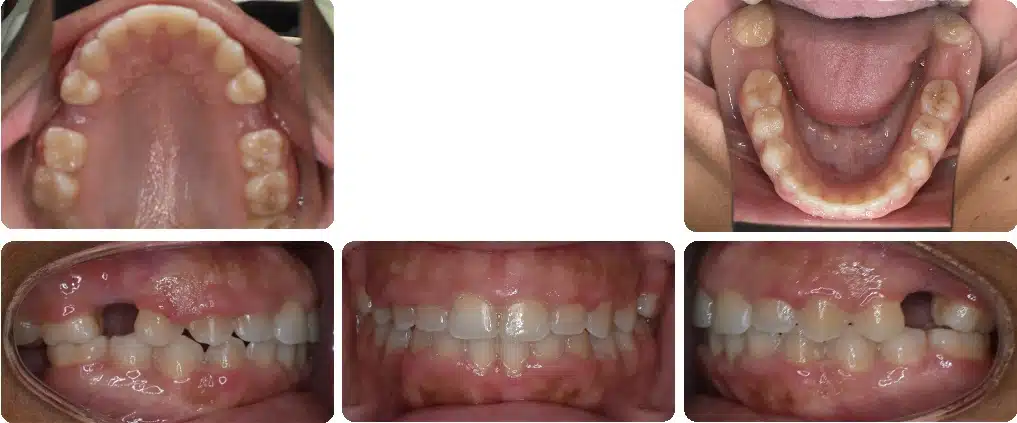 Case #7 After Case #7 After
