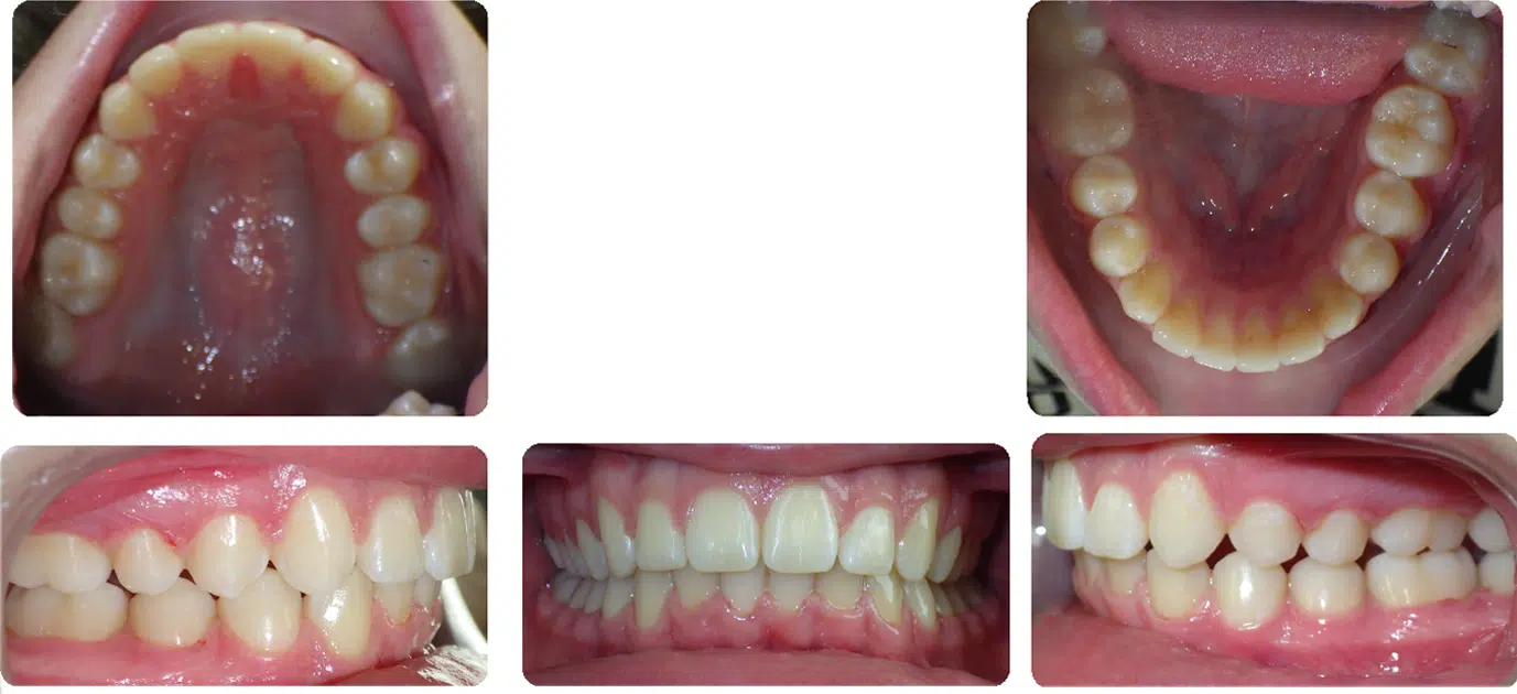 Case #8 After Case #8 After