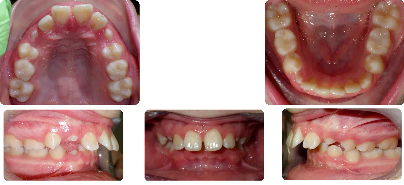 Case #8 Before Case #8 Before